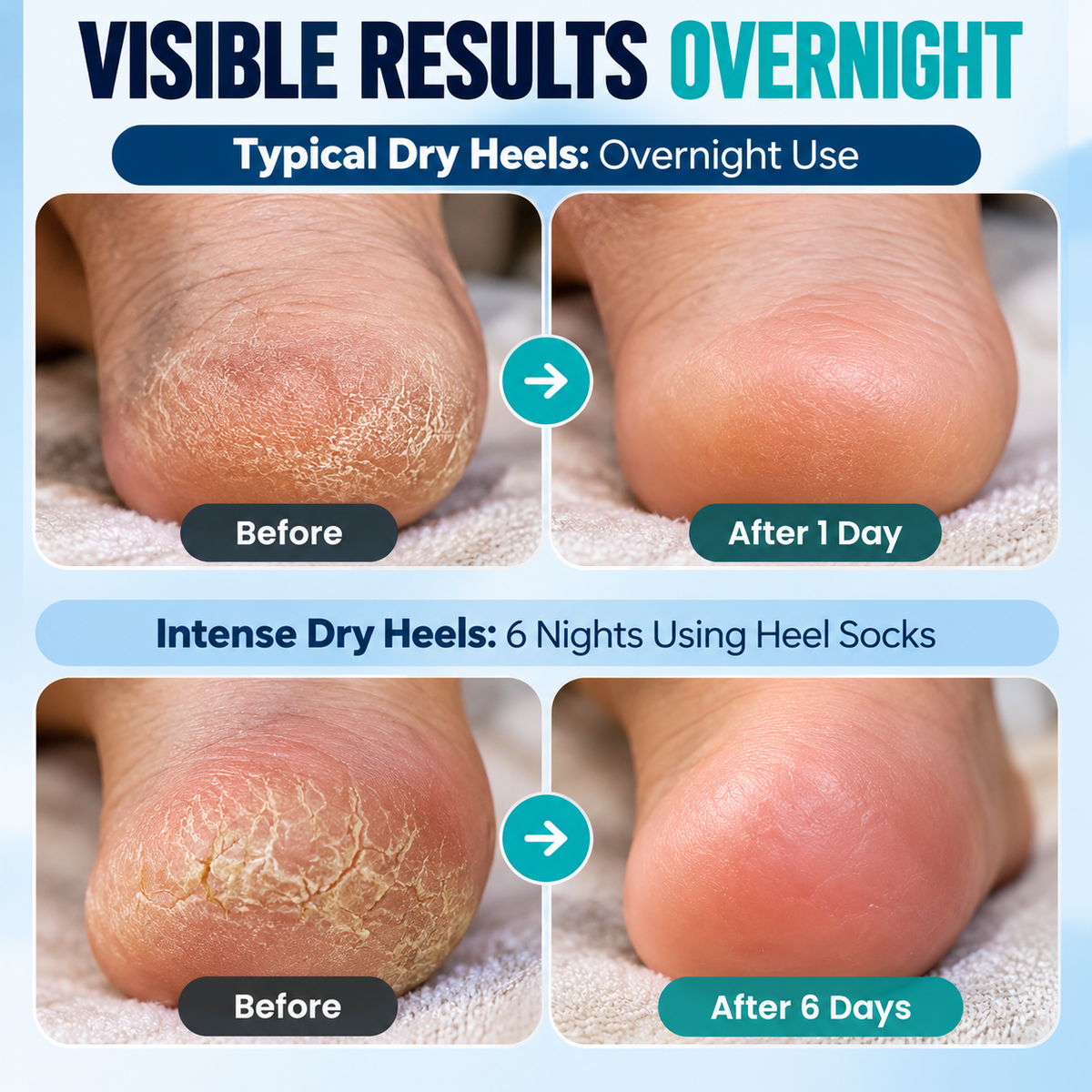 Moisturizing Heel Socks