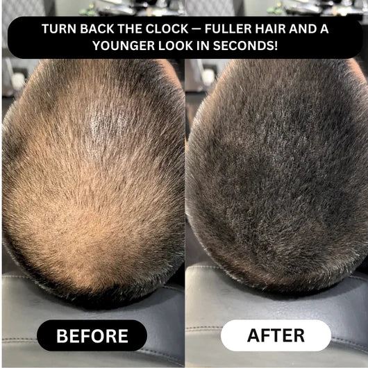 Hair Density Filler