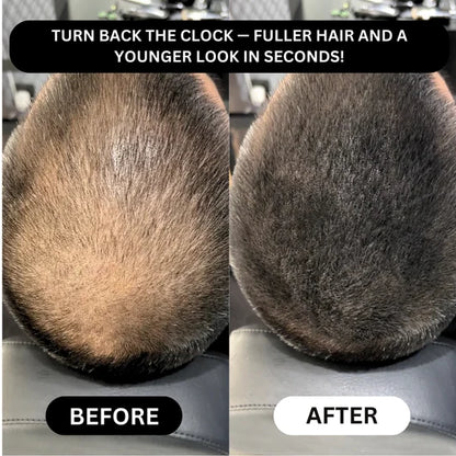 Hair Density Filler