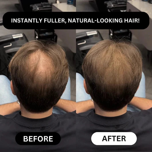 Hair Density Filler