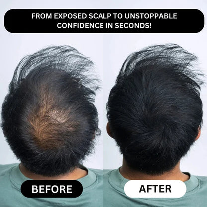 Hair Density Filler
