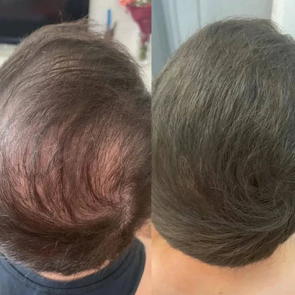 Hair Density Filler