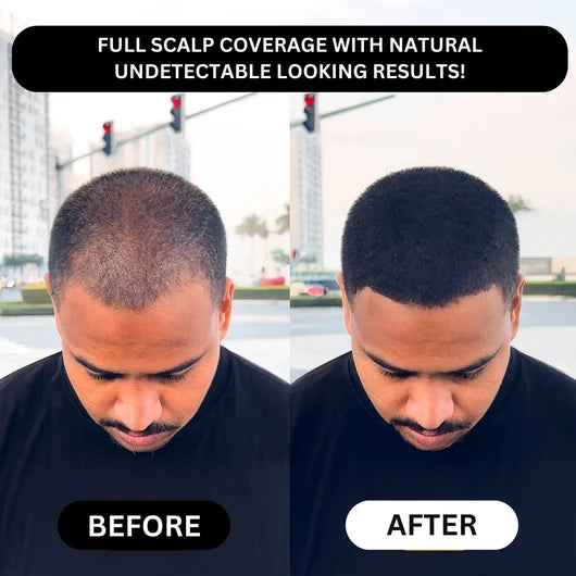 Hair Density Filler