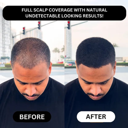 Hair Density Filler